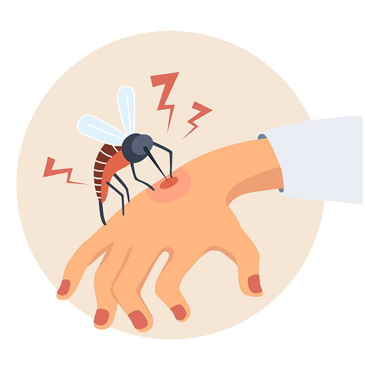 How-to-treat-bug-bites